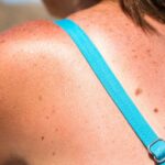 Неожиданные выводы: Что на самом деле причиняет солнечные ожоги?